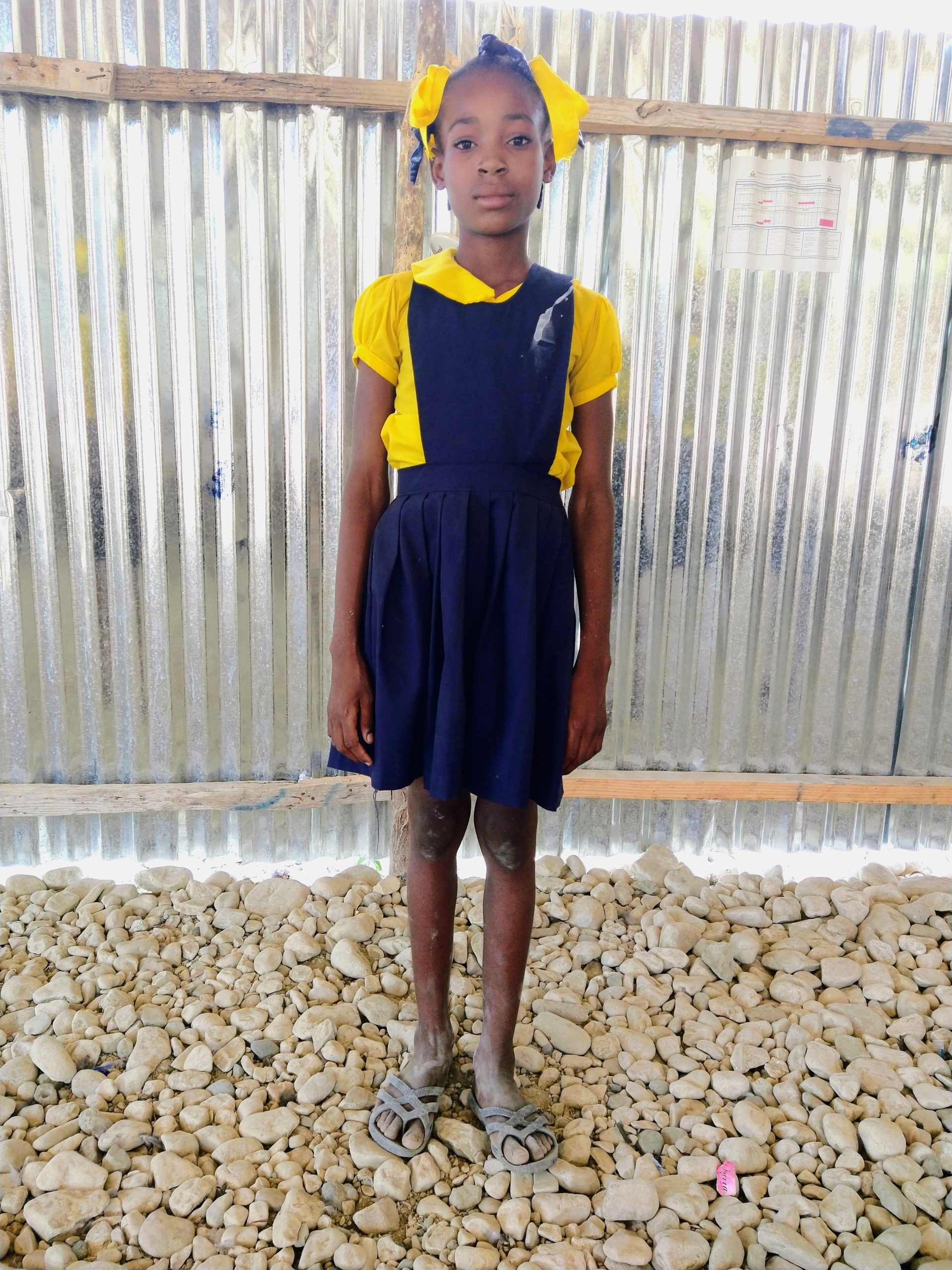 Nodeline, Children Supported by Bethleem Foundation